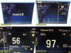 DATASCOPE Passport 2 P/N 0998-00-0170-3135A Monitor