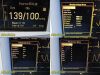 DATASCOPE Passport 2 P/N 0998-00-0170-3135A Monitor