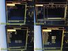 DATASCOPE Passport 2 P/N 0998-00-0170-3135A Monitor