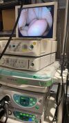 FUJINON EPX-4400 Endoscopy Processor