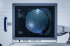 OLYMPUS GIF V2 Video Gastroscope