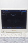 ESAOTE MyLab 25 Gold Portable Ultrasound