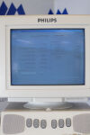 PHILIPS Endivor HD Ultrasound System