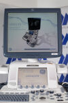 GE Logiq E9 r3 Ultrasound System