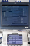GE Logiq E9 r3 Ultrasound System