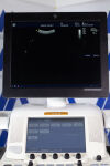 GE Vivid E9 XD Clear Ultrasound System