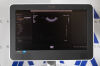 PHILIPS Epiq 5 Ultrasound System