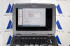 SIEMENS/ACUSON P500 Frosk Portable Ultrasound