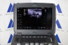 SIEMENS/ACUSON P500 Frosk Portable Ultrasound