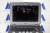 SIEMENS/ACUSON P500 Frosk Portable Ultrasound