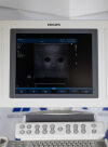 PHILIPS HD11-XE Ultrasound System