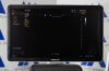 SAMSUNG HS50 Ultrasound System