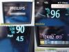 PHILIPS 2011 MP5T M8105AT (865120) Patient Monitor
