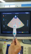 TOSHIBA PST-25BT for sale / repair Ultrasound General