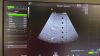 GE C1-5-Rs Ultrasound Transducer