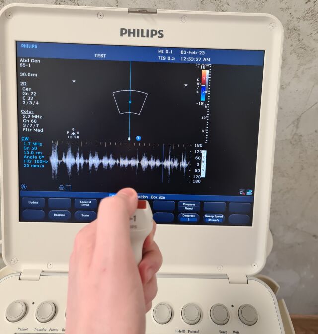 PHILIPS CX50 cart B.0 cardiac ultrasound w/S5-1 Ultrasound - Cardiac