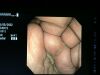 OLYMPUS CF-2T140 Endoscope
