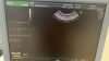 GE RIC5-9-D Ultrasound Transducer