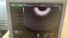GE RIC5-9-D Ultrasound Transducer