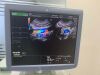 GE RIC5-9-D Ultrasound Transducer