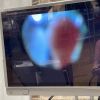 WELCH ALLYN FX-100 Sigmoidoscope