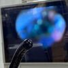 WELCH ALLYN FX-100 Sigmoidoscope