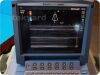 SONOSITE/MICROMAXX P08840-02   Ultrasound System