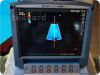 SONOSITE/MICROMAXX P08840-02   Ultrasound System