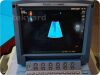 SONOSITE/MICROMAXX P08840-02   Ultrasound System