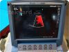 SONOSITE/MICROMAXX P08840-02   Ultrasound System