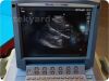 SONOSITE/MICROMAXX P08840-02   Ultrasound System