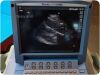 SONOSITE/MICROMAXX P08840-02   Ultrasound System