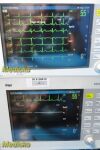SIEMENS Drager Infinity Delta Monitor EN MS13466E539D W/ Dock & Patient Leads ~ Monitor
