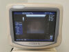 GE Logiq 7 Ultrasound - Cardiac