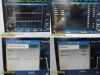 DRAEGER Infinity Gamma XL MS18985E551D W/ Dock, Printer & Patient Leads