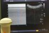 TOSHIBA PVT-575MV Ultrasound Transducer