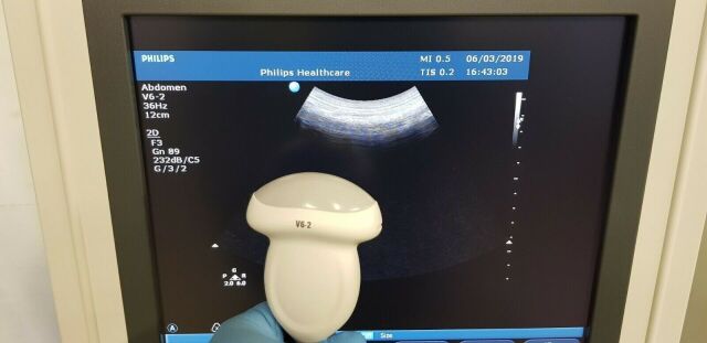 PHILIPS V6-2 Convex Ultrasound Transducer