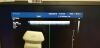 PHILIPS L17-5 Ultrasound Transducer