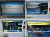 COVIDIEN 2015  Nellcor GBB1502811 BRPMS SpO2 Monitor