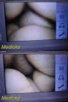 KARL STORZ 8401ZX C-Mac Video Laryngoscopy Monitor