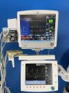 DATEX-OHMEDA Aespire View with GE Carescape B650 Monitor Anesthesia Machine
