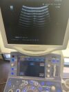 HITACHI ProSound Alpha 7 ProSound Alpha 7 Ultrasound System with Probes