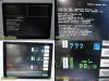 SPACELABS 90369 Multi-Parameter Monitor