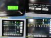 SPACELABS 90369 Multi-Parameter Monitor