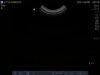 SONOSITE C11e Ultrasound Transducer
