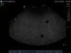 SONOSITE C11e Ultrasound Transducer