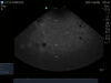 SONOSITE C11e Ultrasound Transducer