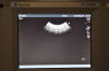 SONOSITE C15 Ultrasound Transducer