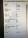 HOLOGIC Selenia Dimensions 2D/3D Mammography System Digital Mammo Unit