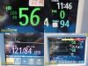PHILIPS MP30 Intellivue, W/ MMS 3001A Module & Leads~  Multi-Para Monitor